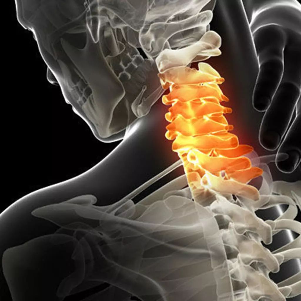 How to treatment of Cervical Pain