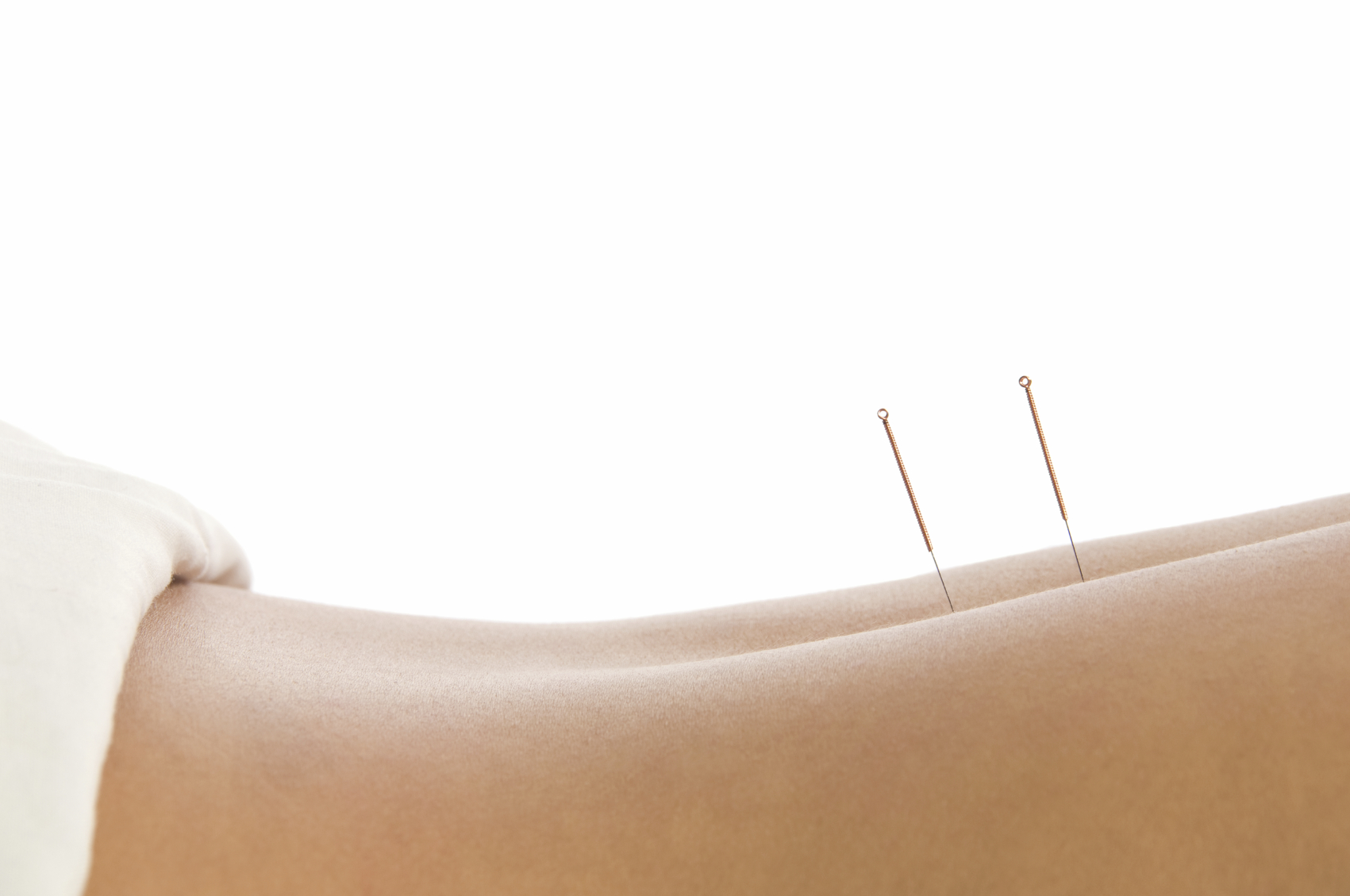 Would acupuncture treatments help chronic low back pain