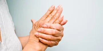 Carpal tunnel Syndrome with chiropractic care