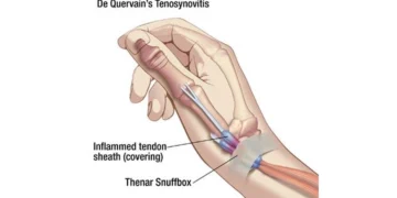 thumb pain with chiropractor near me